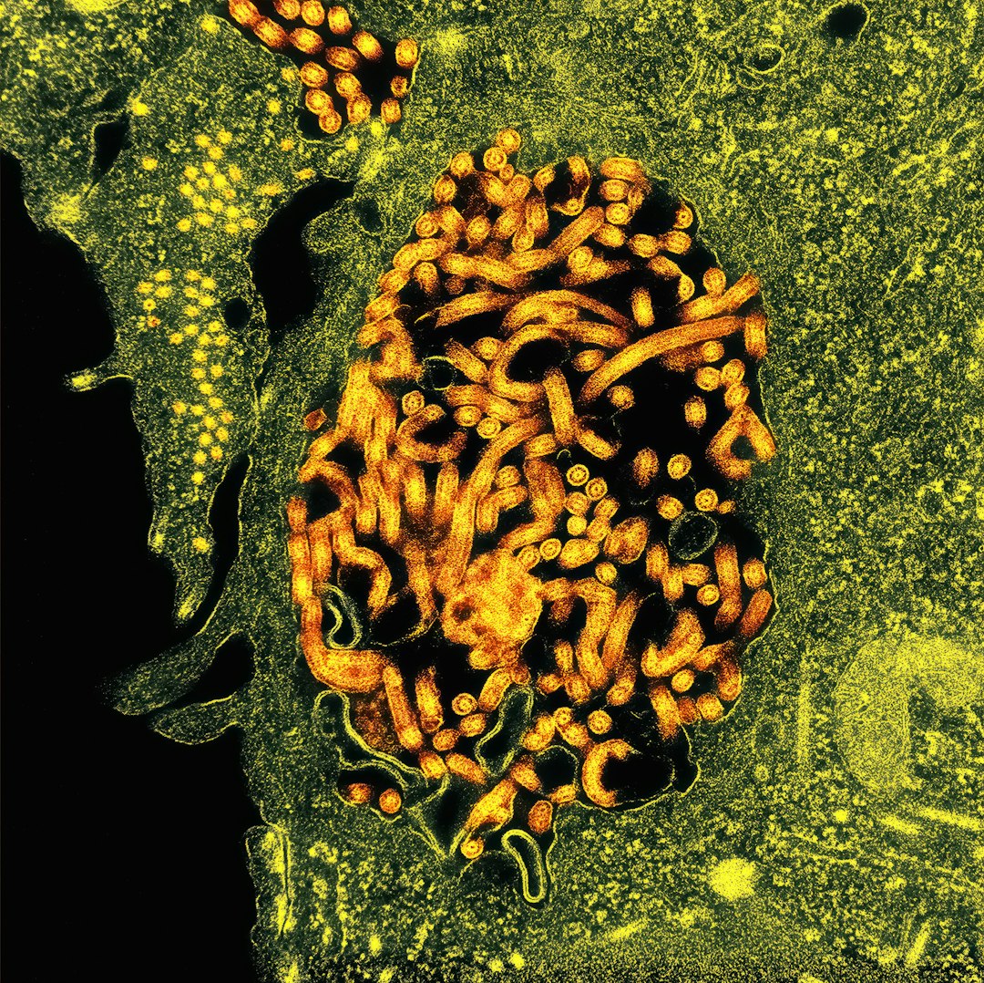 3 Deadly Mpox Cases Hit SoCal - Are You Safe?